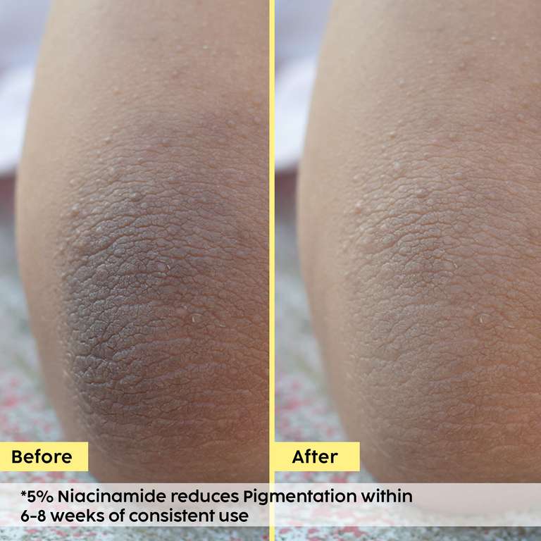 Plix Pineapple Bright Polishing Cream for Dark Underarms & Even-Toned Skin, 50g